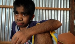 Cậu bé được tôn sùng như vị thánh ở Indonesia